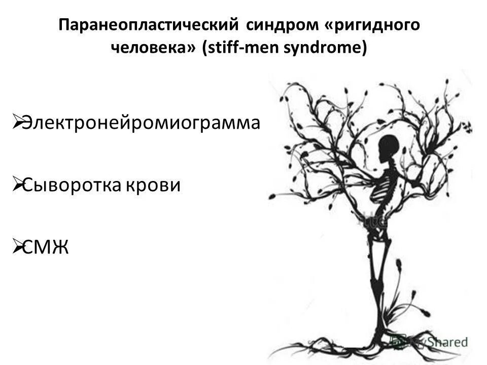Паркинсонизм синдром поражения экстрапирамидной. Дрожательно-ригидный синдром. Синдром ригидного человека. Синдром ригидного человека. Синдром фригидного человека.