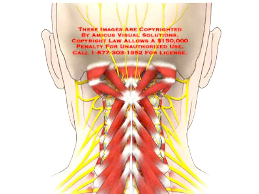 Подзатылочные мышцы шеи анатомия. Мышцы разгибатели шейного отдела. Анатомия шейного отдела мышцы. Экстензоры шеи анатомия. Нейропатия затылочного нерва