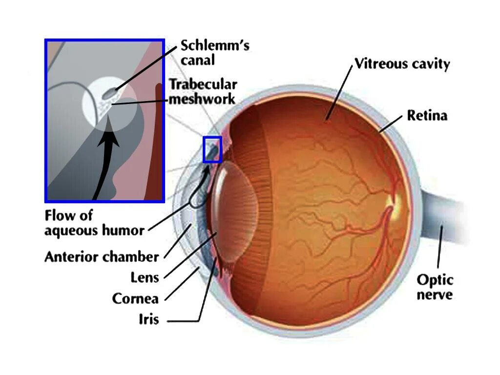 Глаукома схема. Очки для глаукомы. Глаукома латынь