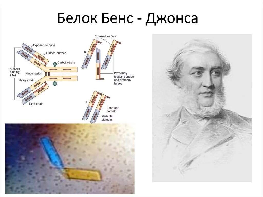 Исследование на белок Бенс-Джонса методика. Белок Бенс Джонса строение. Определение белка Бенс-Джонса в моче методика. Белок Бенс-Джонса в моче методика.