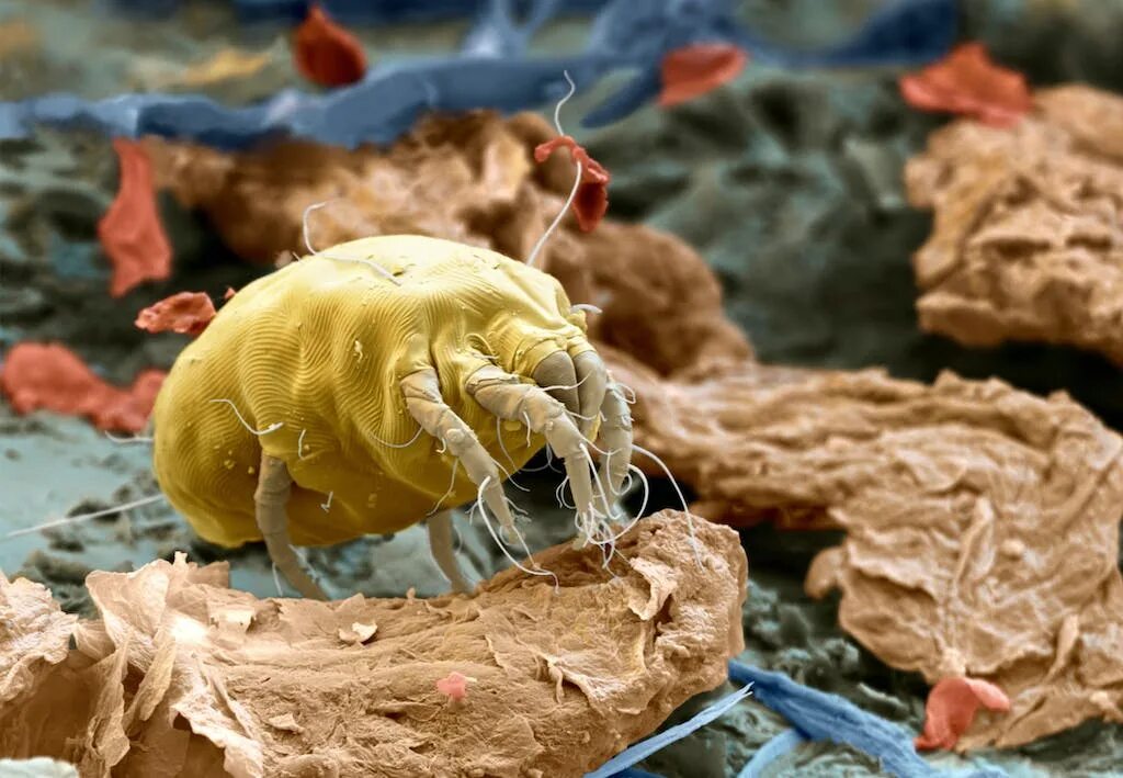 Аллергены клещей домашней пыли. Пылевой клещ сапрофит. Бельевой клещ под микроскопом.