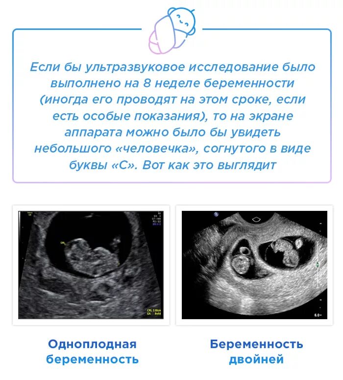 УЗИ 8 недель. УЗИ 8 недель беременности. 7-8 Недель беременности по УЗИ. 8 Недель беременности по УЗИ. 8 недель тошнота