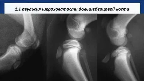 Берцовая кость у собаки