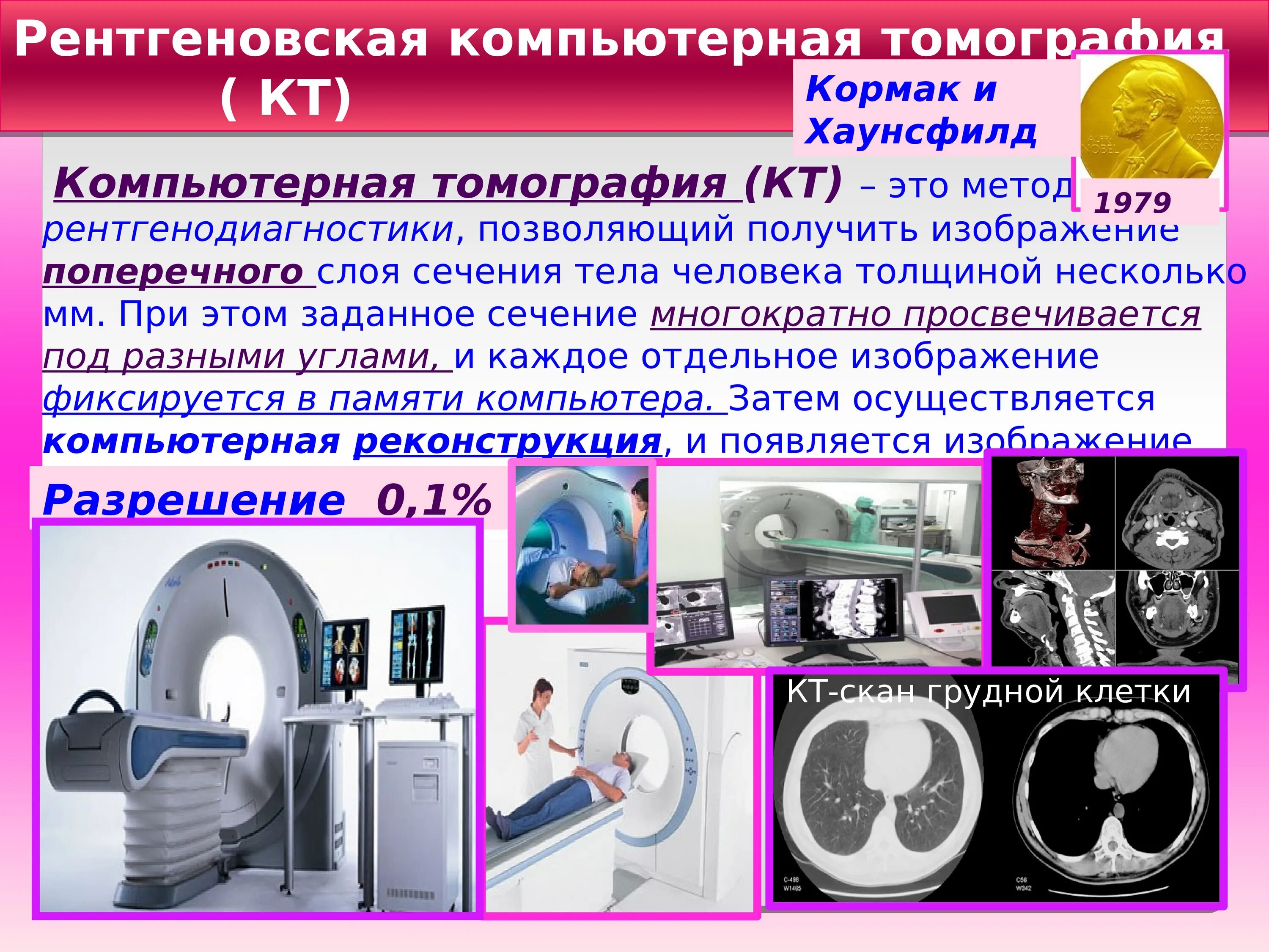 Что такое ркт. Рентгеновская томография. Рентгеновский компьютерный томограф. Методы компьютерной томографии. Рентгено компьютерная томография.