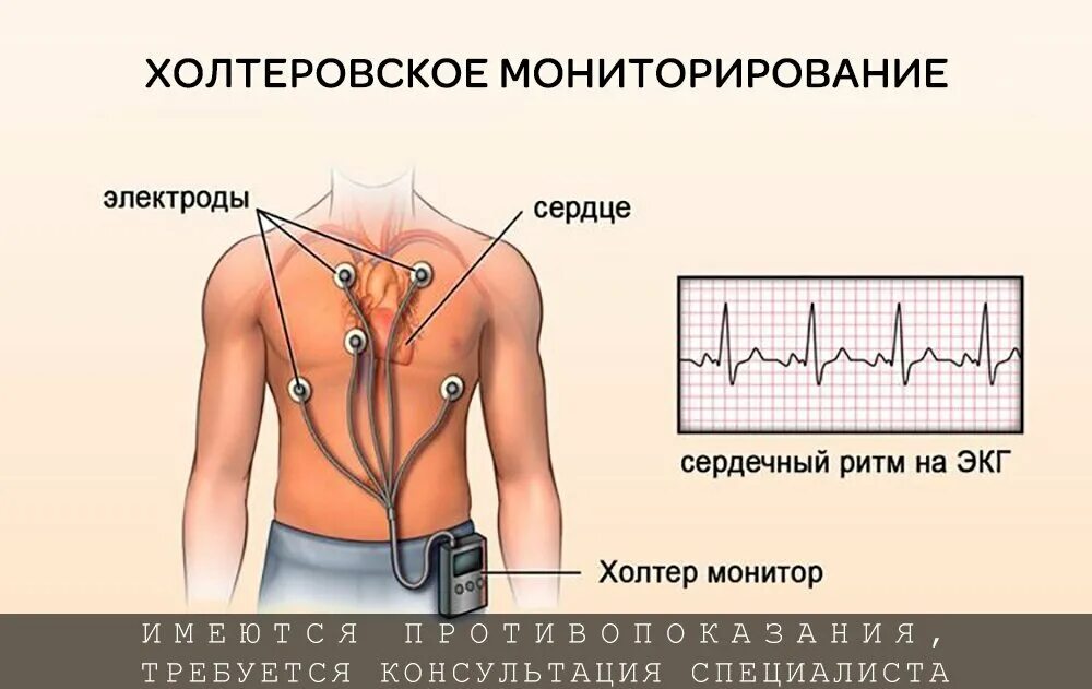 Как проводить холтеровское мониторирование. Суточное мониторирование экг методика проведения. методика холтеровского мониторирования экг. методика суточного мониторирования экг. холтеровское мониторирование цель исследования.