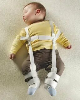 Дисплазия тазобедренного сустава шина