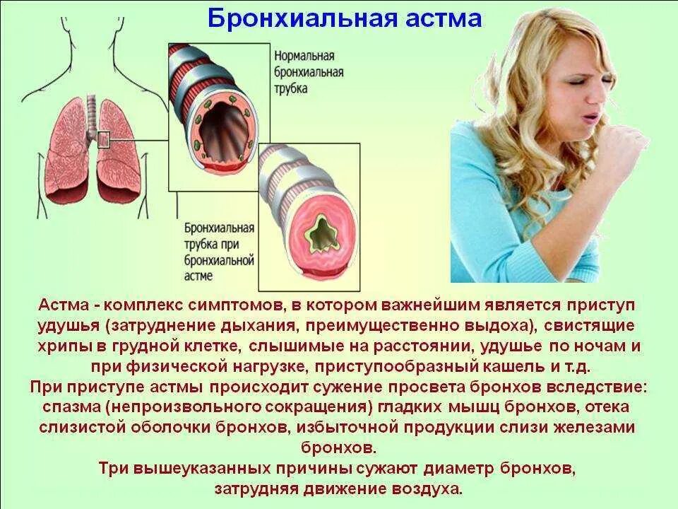 Лечение легкой астмы. Бронхи при бронхиальной астме. Бронхи при астме. Бронхиальная астма это заболевание.