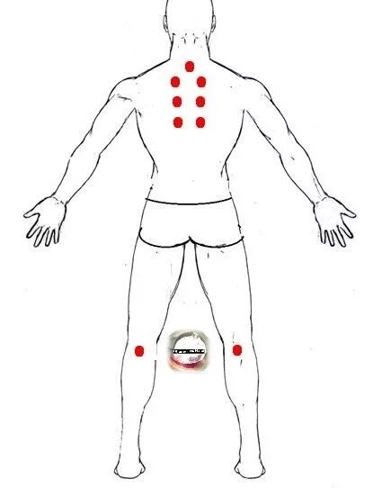 Банки при болях в спине. Хиджама схема постановки банок на спину. Атлас хиджама точки простаты. Точки для простаты хиджама.