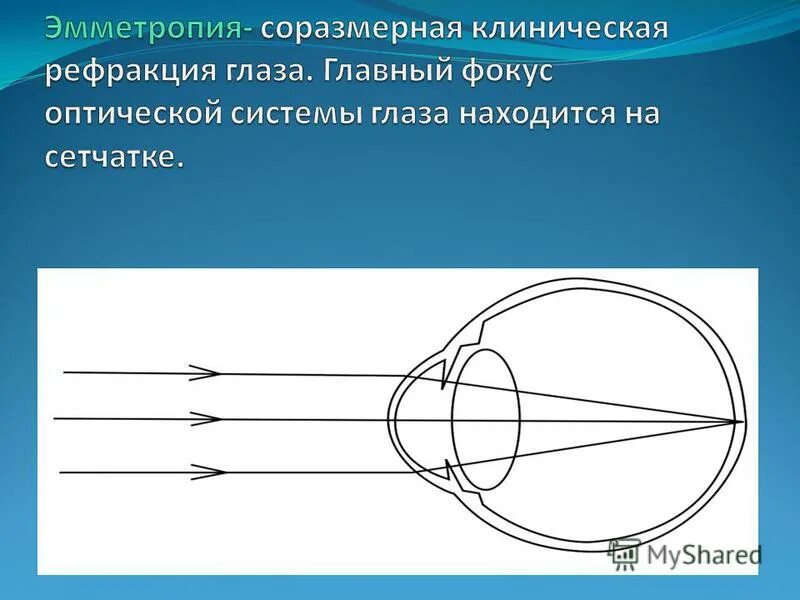 аккомодация.