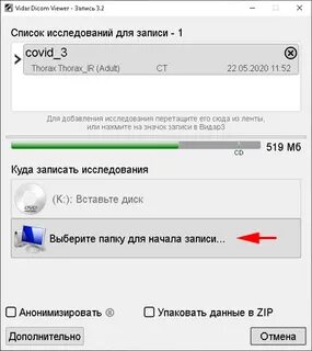 Установить скорость записи