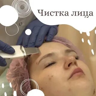 Чистка лица видео 79218092120 etalon pmu