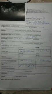 После осмотра на кресле
