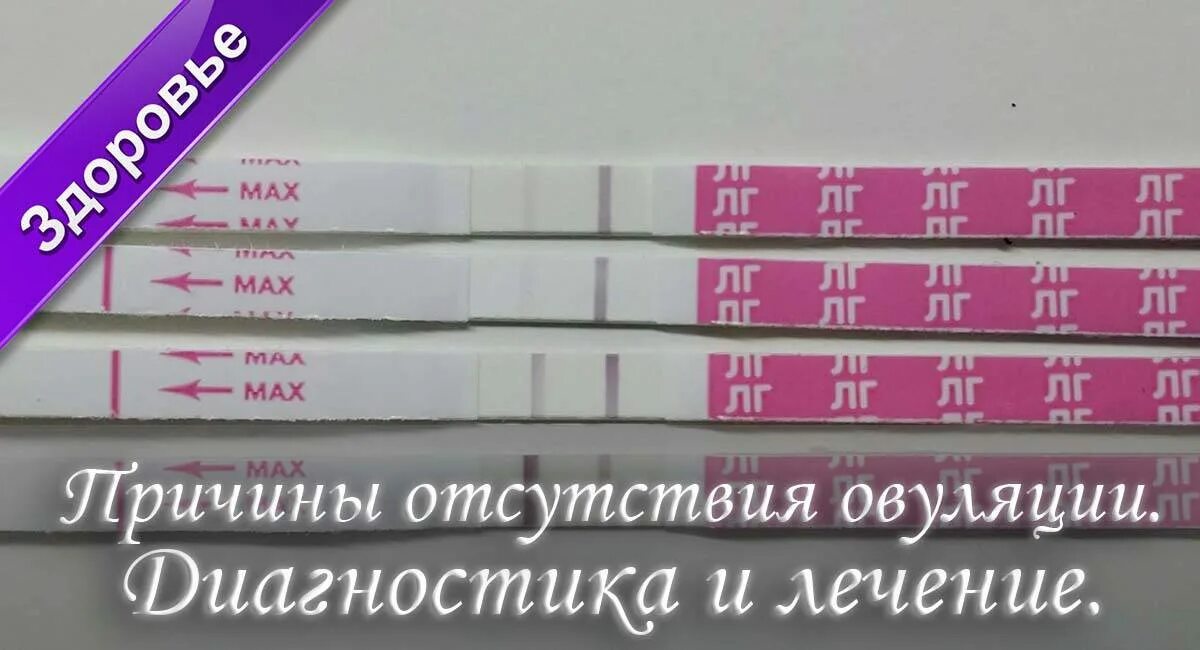 Почему нет овуляции. Отсутствие овуляции. отсутствие овуляции лечение. отсутствие овуляции причины.