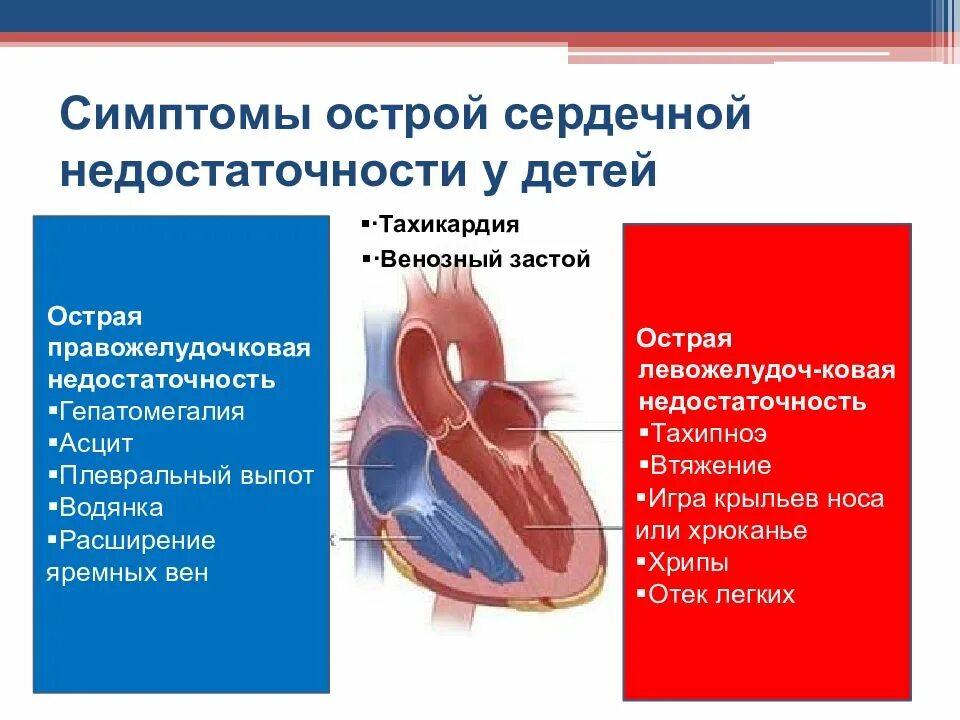 Проявление острой сосудистой недостаточности. Симптомы острой сердечной недостаточност. Сердечная недостаточность симптомы у детей. Ребенок с сердечной недостаточностью. Симптомы острой сердечной недостаточности у детей.