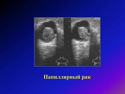 Папиллярные железы