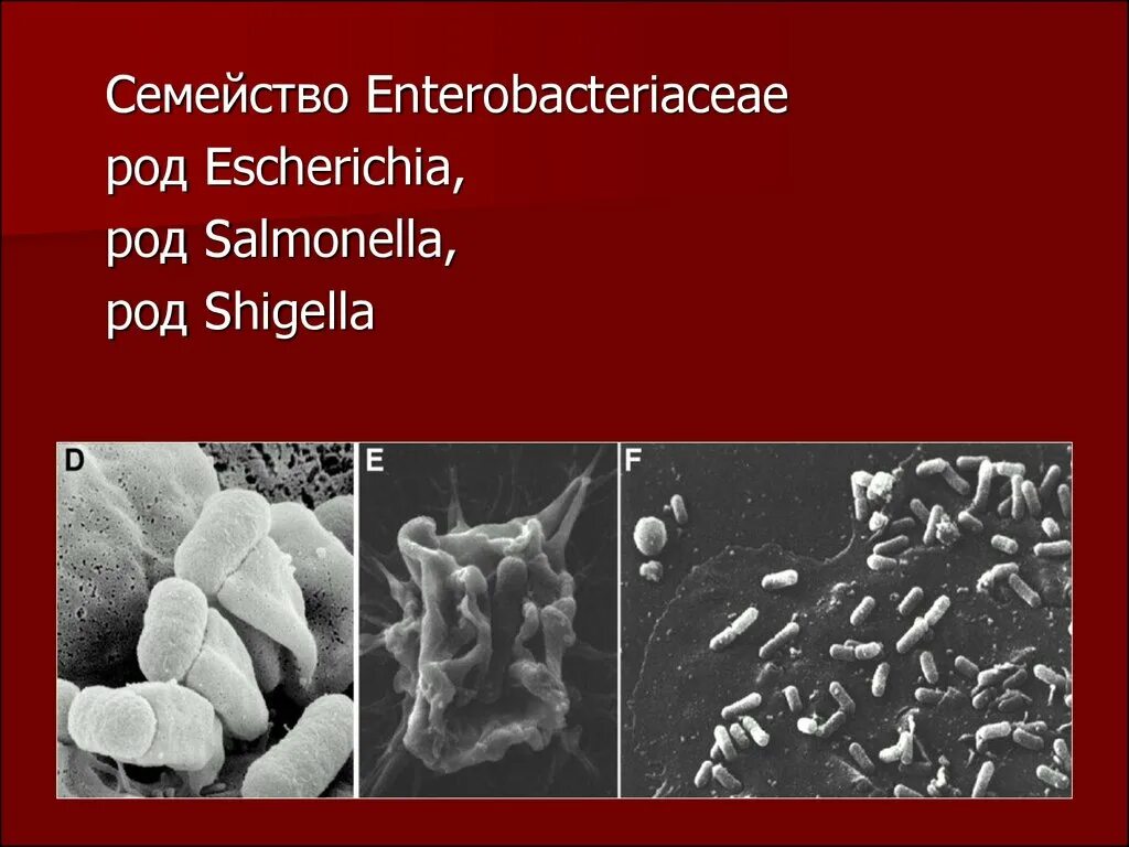 Spp salmonella spp shigella spp. Семейство enterobacteriaceae. enterobacteriaceae род. salmonella семейства enterobacteriaceae.. salmonella семейство.