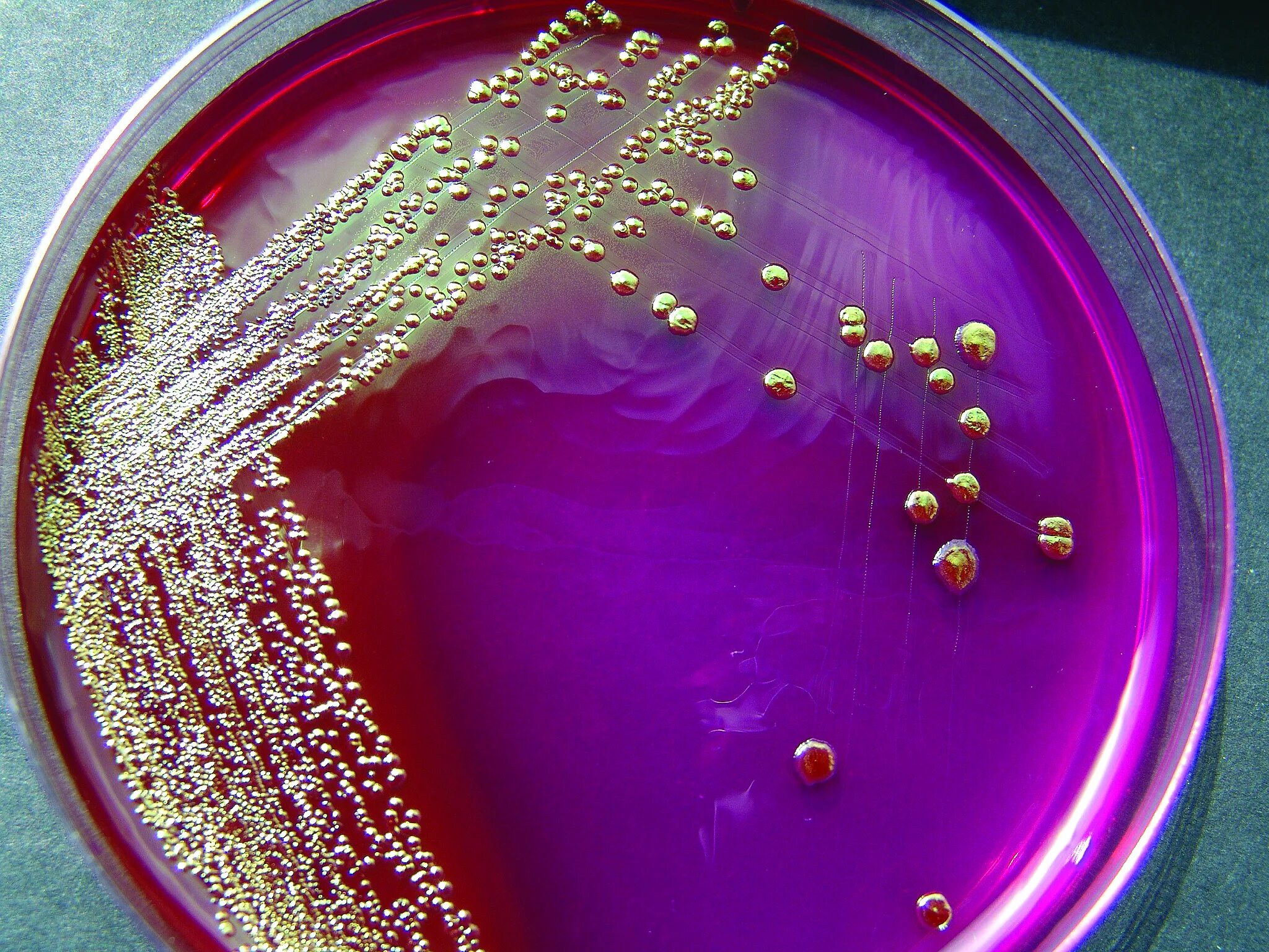 Эшерихиоз сальмонеллез. Эшерихия на чашке Петри. Escherichia coli на среде Эндо. Escherichia coli в чашке Петри. Рост эшерихии на среде Эндо.