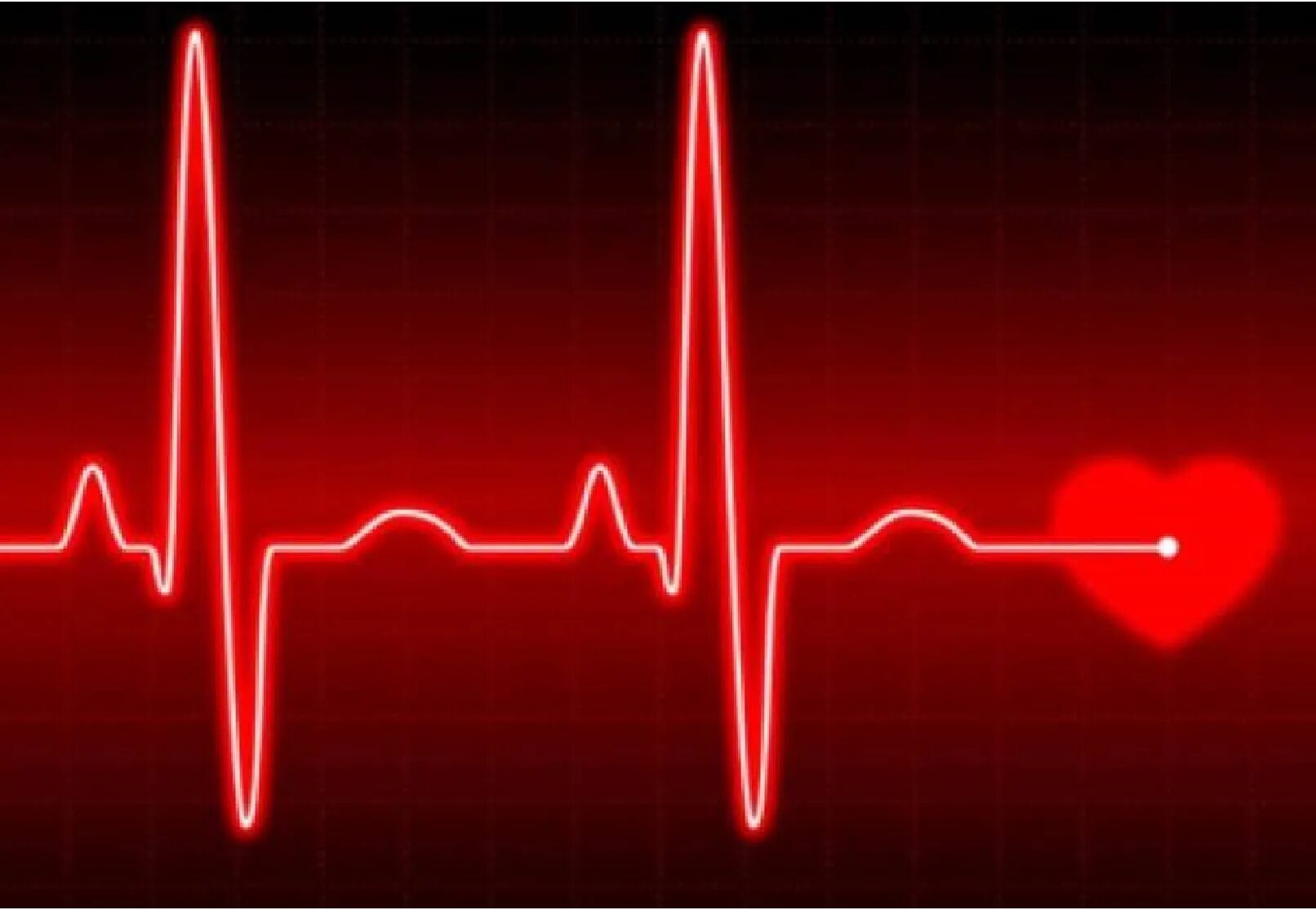 Легкое сердцебиение. Пульс сердца. Кардиограмма. Кардиограмма сердца. Линия пульса.