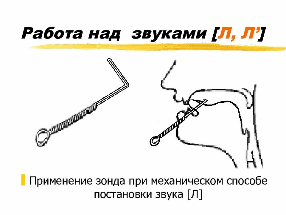 Постановка звука л механическим способом зондом. Постановка звука л с механической помощью. Постановка звука л от мягкого л. Логопедический зонд для постановки звука л.