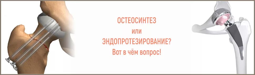 Ограничения после эндопротезирования. Шейка бедра эндопротез. Остеосинтез тазобедренного сустава реабилитация. Перелом шейки бедра эндопротезирование тазобедренного сустава. Перелом шейки бедра операция эндопротез.