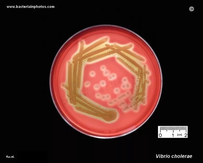 Трутовик окаймленный холерный вибрион. Рост Vibrio parahaemoliticus на среде VP. MACCONKEY Agar Vibrio cholerae. Набор для идентификации Vibrio cholerae. Вибрион в еда.