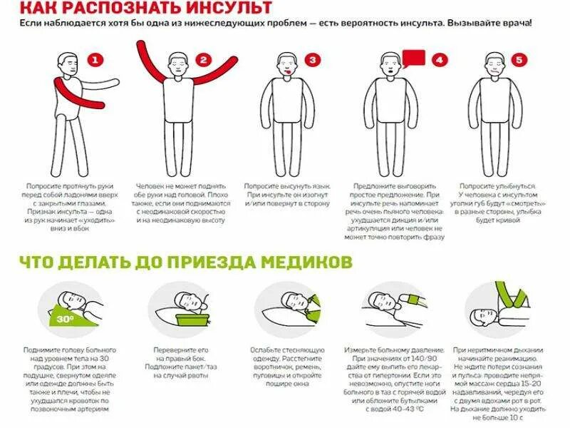 Какие симптомы приступа