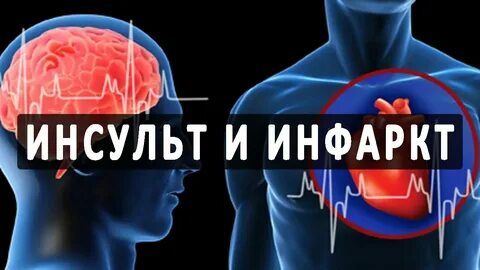 Инфаркт или инсульт разница