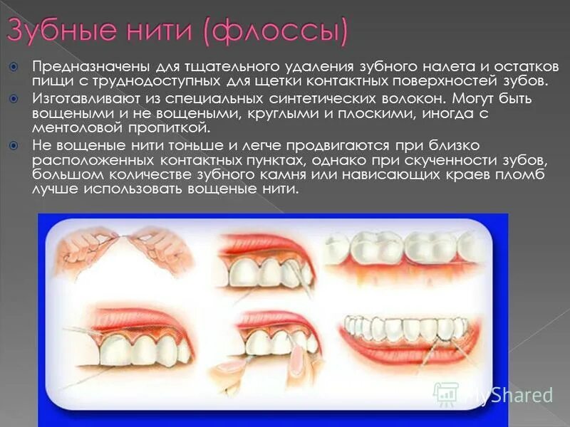 Значение зубного налета