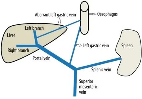 Left open