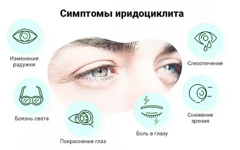 Капли при иридоциклите