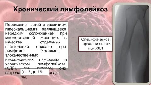 Поражение 40