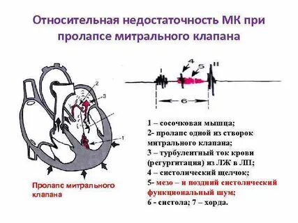 Недостаточность тк 1