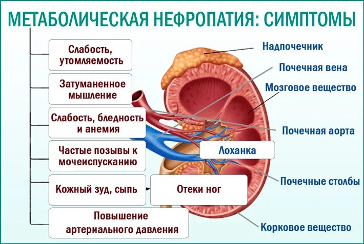 Классификация дисметаболической нефропатии. Дисметаболические изменения почек у ребенка. Поражение почек при обменных нарушениях у детей. Метаболическая нефропатия у детей.