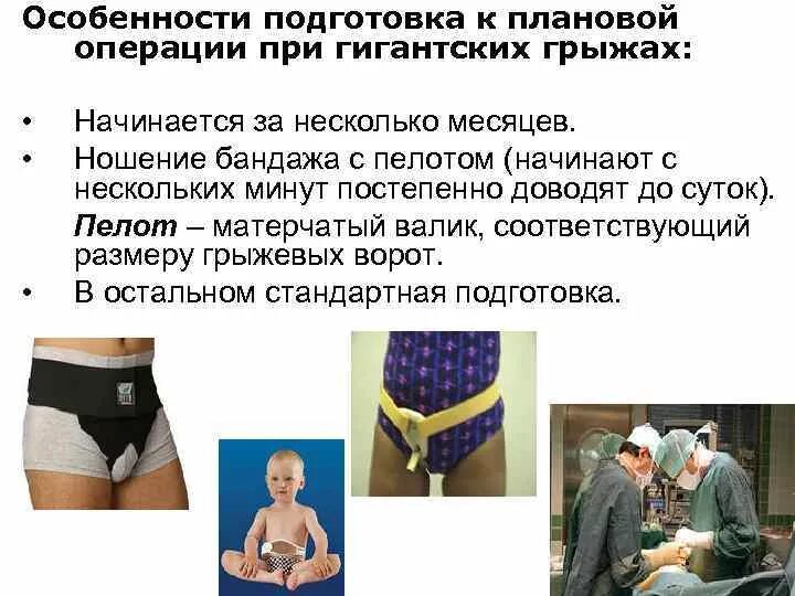 После грыжи сколько кг можно поднимать. Гигантская послеоперационная вентральная грыжа. бандаж для брюшной грыжи мужской. бандаж брюшной послеоперационный мужской. бандажи противогрыжевые на брюшную стенку.