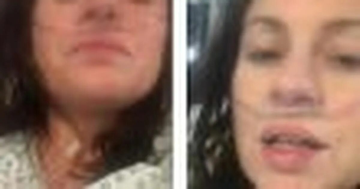 Почему синеют губы. Синюшные губы у женщин.