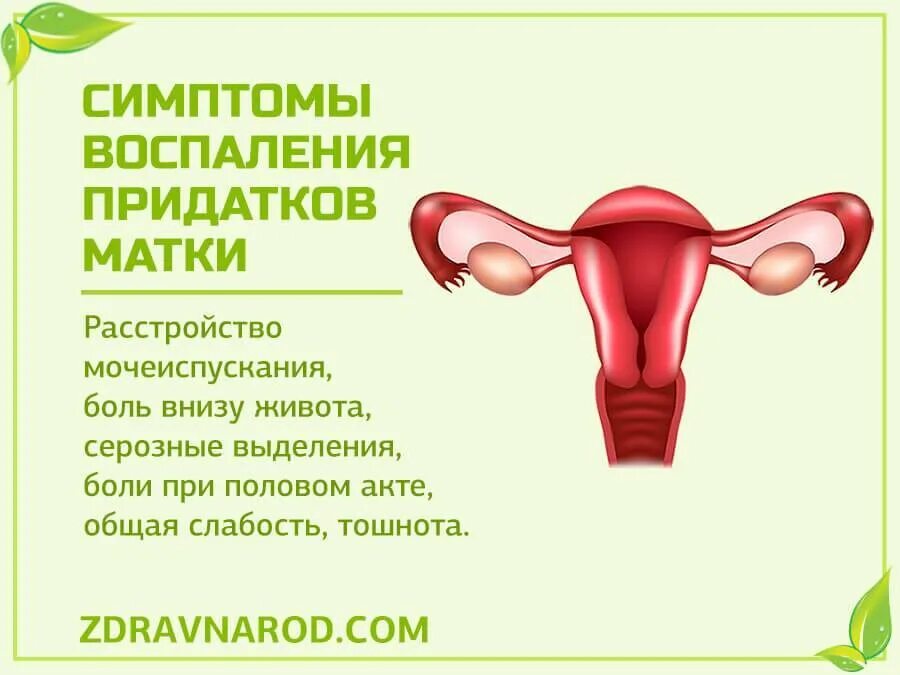 Воспаление придатков у женщин. Воспаление придатков матки симптомы. Придатки матки воспаление. Почему болит низ матки