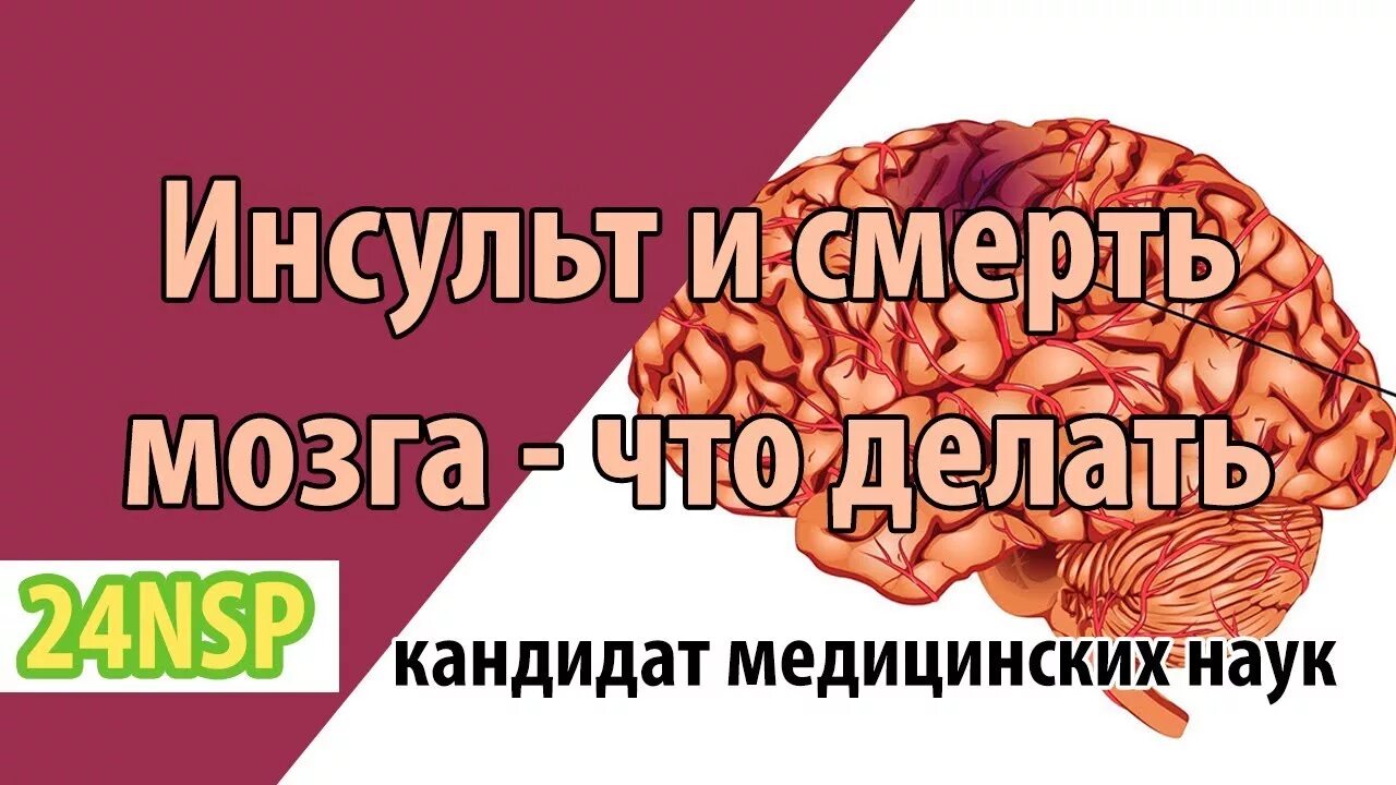 Лечение мозга после инсульта. Как восстановить мозг после инсульта. Как восстанавливается мозг после инсульта. Перитонит мозга после инсульта. Как развивать мозг после инсульта.