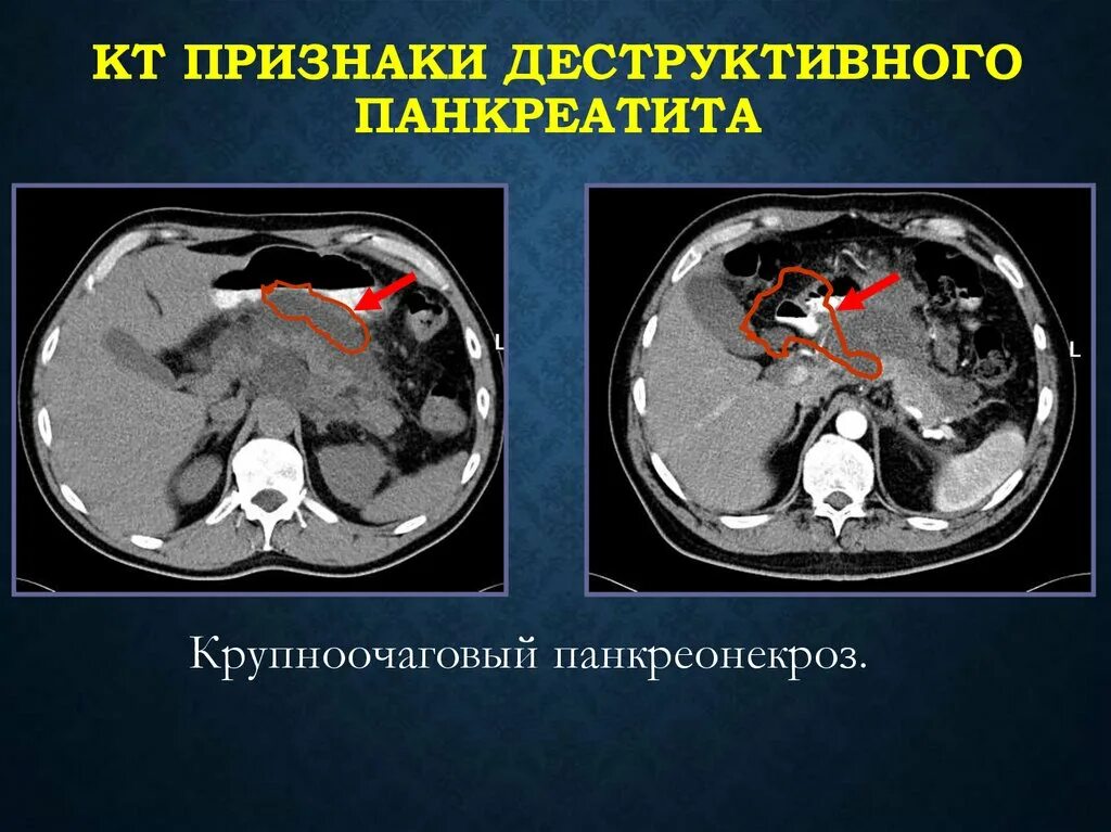 Симптомы кт. Симптомы кт