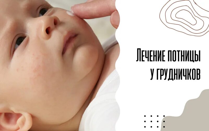 Как выглядит потница у детей 1 год Что это! 32 ответов форум Babyblog