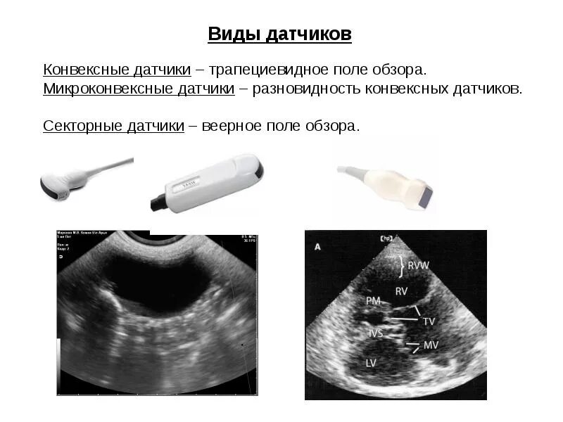 Как называется узи для определения. Секторный датчик узи изображение. датчики в узи линейный и конвексный. тип датчика узи секторный изображение. конвексный датчик узи изображение.