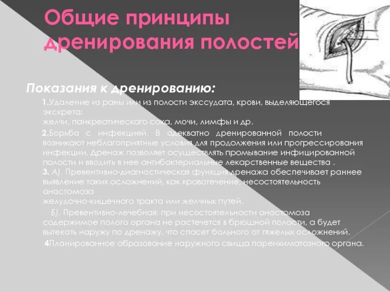 Дренирование раны и полостей. Показания к дренированию раны. дренирование ран и полостей. дренирование ран и полостей тела. активное дренирование показания.