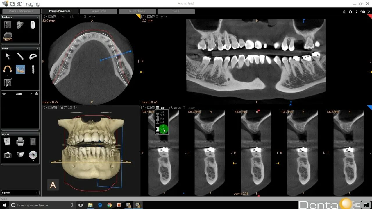 Cs imaging. Cs 3d imaging. cs 3d imaging загрузка dicom. программа kodak cs 3d imaging. cs 3d imaging инструкция по использованию.