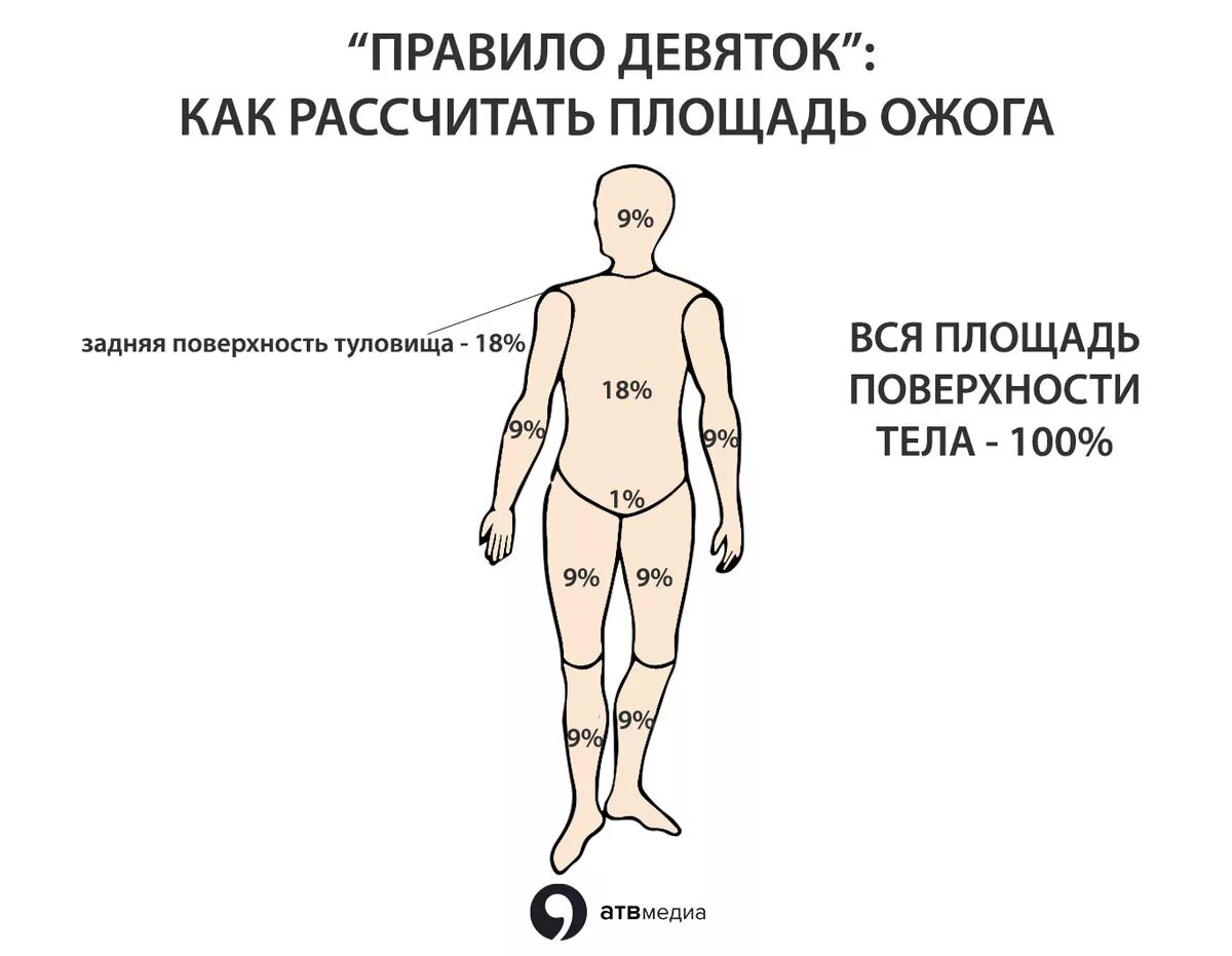 Ожоги проценты поражения. Площадь ожога правило девяток. Площадь ожоговой поверхности правило девяток.