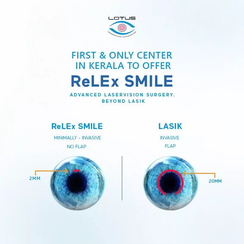 Коррекция зрения смайл цена со скидкой спектр. RELEX smile. Лазерная коррекция зрения методом smile. Лазерная коррекция RELEX. Метод лазерной коррекции RELEX smile.