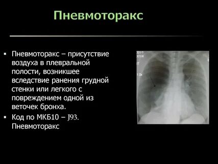 Полость возникать