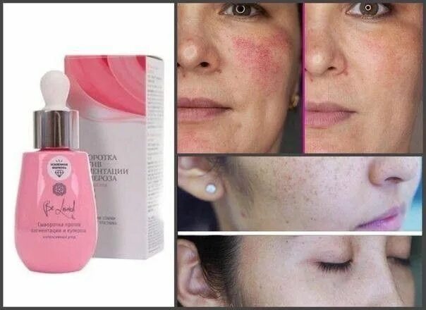 Сыворотка для лица до и после The Ordinary 30ml Serum Alpha Arbutin 2% +HA Serum купить по низким ценам в ин