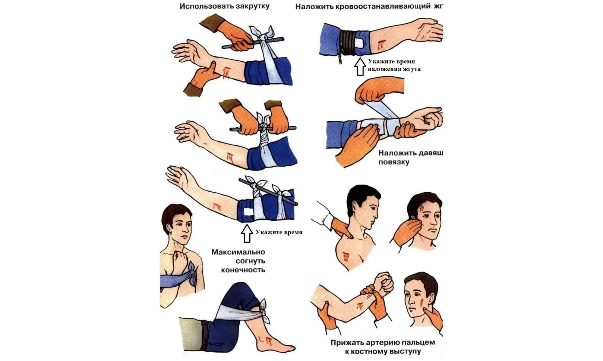 Как остановить обильное кровотечение тест. Алгоритм оказания первой помощи при ранениях и кровотечениях. Оказание первой медицинской помощи при ранениях кратко. Порядок оказания первой медицинской помощи при ранении. Первые правила оказания первой медицинской помощи при ранении.
