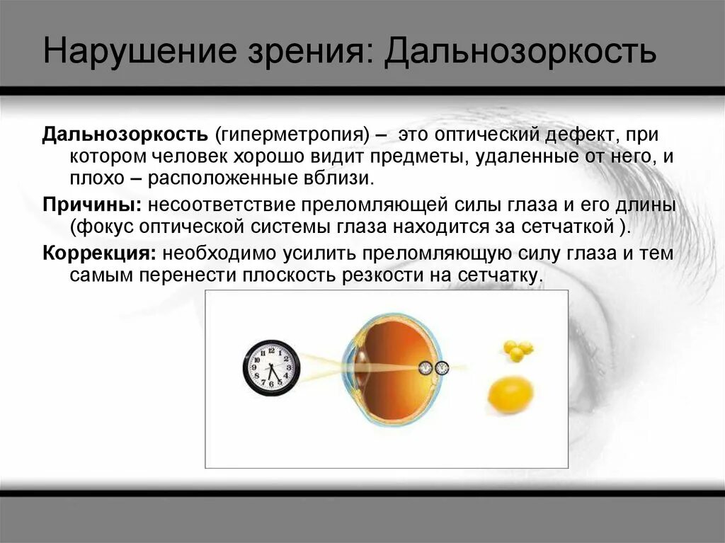 Причины появления дальнозоркости. Нарушение зрения дальнозоркость. гиперметропия причины. дальнозоркость причины возникновения. дефекты зрения дальнозоркость.