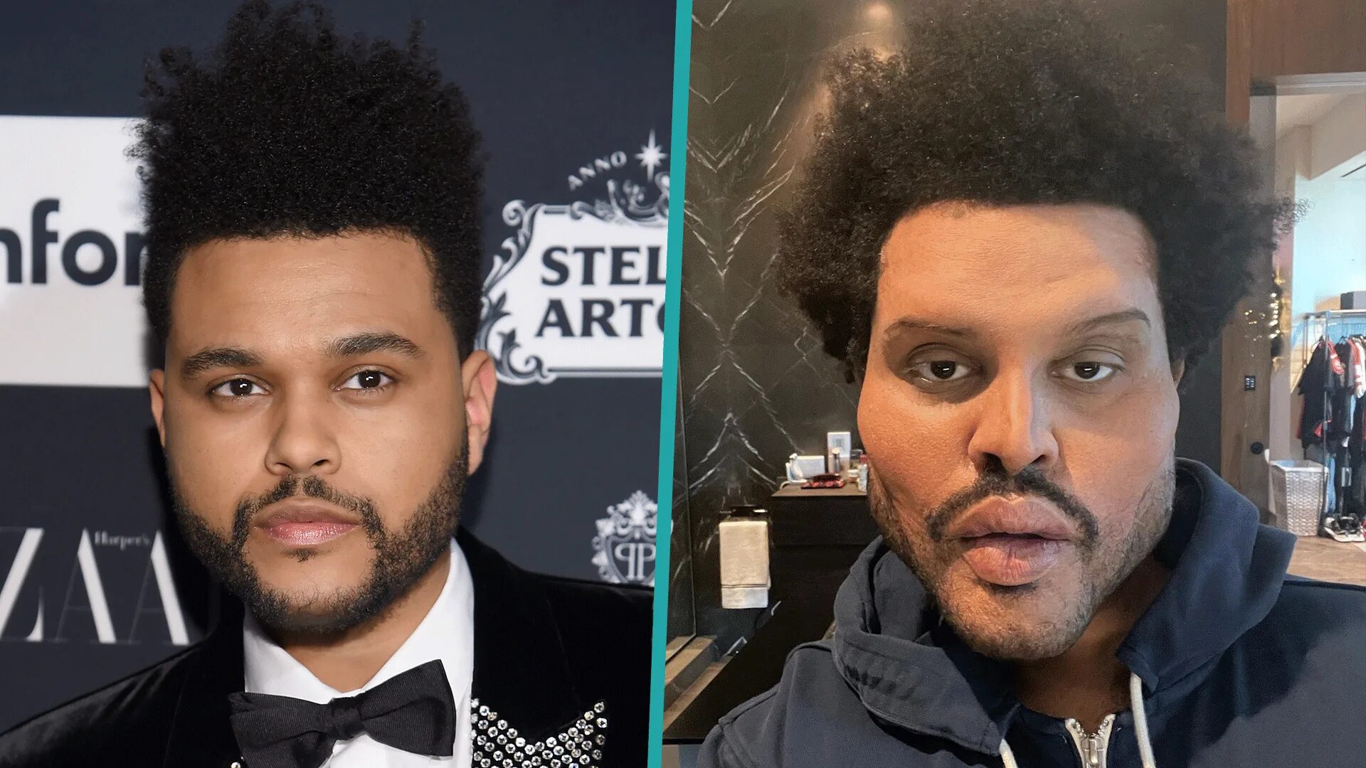 Бывшая weekend. The Weeknd певец 2021. The Weeknd 2021 пластика. The Weeknd сейчас. The Weeknd 2022 певец.