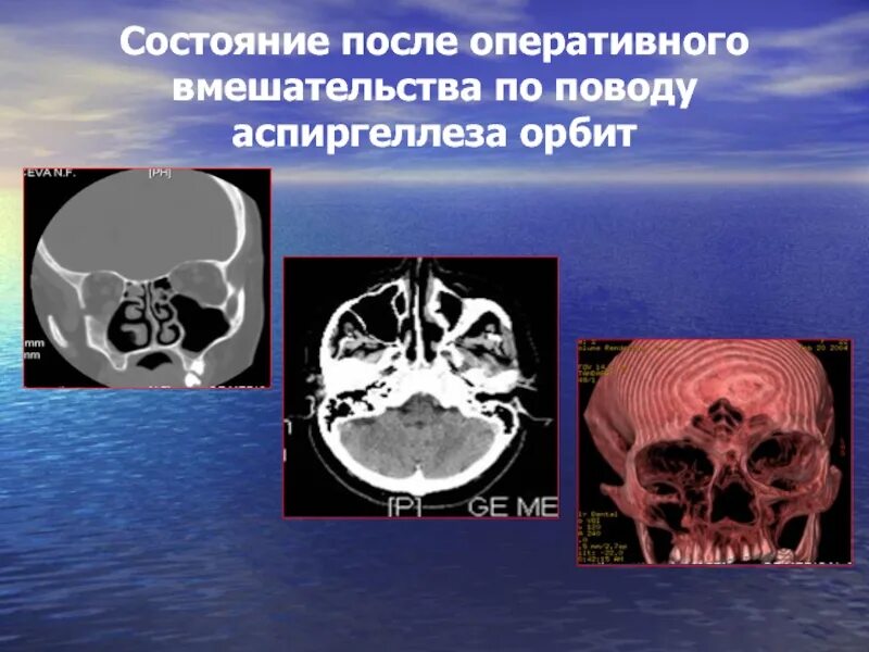 Состояние после оперативного лечения код